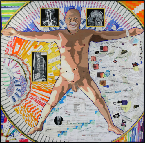 Alive-&-Well-Brian-Parker-Artist I have an idea that when I paint a portrait it should contain more information than just a simple likeness. I painted this just after I turned 60 and it shows a nude me - Alive & Well and surrounded by a collage of medical bills and info leaflets, pill packets of all the drugs I've taken plus scans and X-rays.